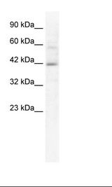 Jurkat Cell Lysate