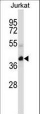 KCTD10 Antibody western blot of Jurkat cell line lysates (35 ug/lane). The KCTD10 antibody detected the KCTD10 protein (arrow).