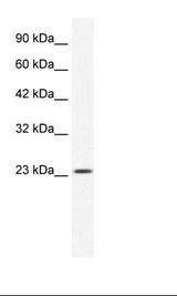 HepG2 Cell Lysate
