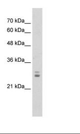 Jurkat Cell Lysate