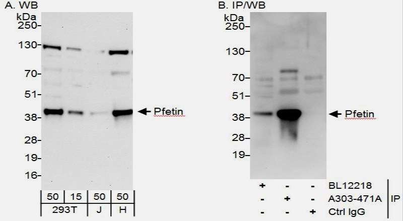 Detection of Human Pfetin by Western Blot and Immunoprecipitation. Samples: Whole cell lysate from 293T (15 and 50 ug for WB; 1 mg for IP, 20% of IP loaded), Jurkat (J; 50 ug) and HeLa (H; 50 ug) cells. Antibodies: Affinity purified rabbit anti-Pfetin antibody used for WB at 0.1 ug/ml (A) and 1 ug/ml (B) and used for IP at 6 ug/mg lysate. Pfetin was also immunoprecipitated by rabbit anti-Pfetin antibody BL12218, which recognizes an upstream epitope. Detection: Chemiluminescence with exposure times of 30 seconds (A) and 10 seconds (B).
