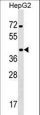 KCTD13 Antibody western blot of HepG2 cell line lysates (35 ug/lane). The KCTD13 antibody detected the KCTD13 protein (arrow).