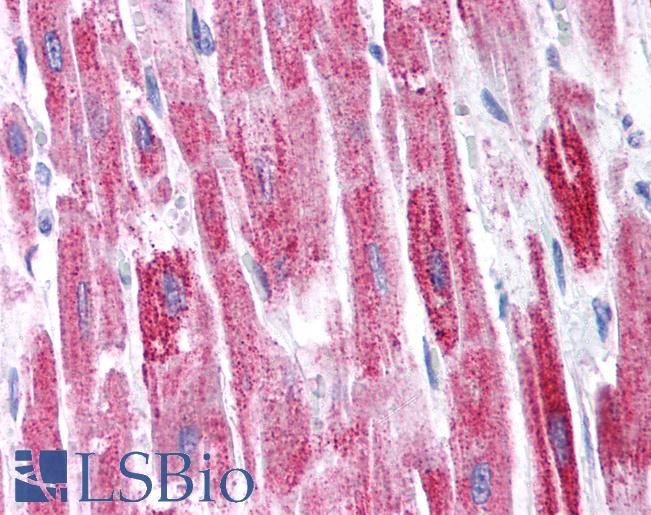 Anti-KCTD13 antibody IHC of human heart. Immunohistochemistry of formalin-fixed, paraffin-embedded tissue after heat-induced antigen retrieval. Antibody LS-B982 concentration 5 ug/ml.