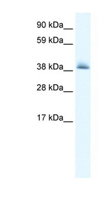 KCTD13 antibody LS-B982 Western blot of Fetal heart lysate.