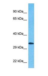 Western blot of KCD15 Antibody with human NCI-H226 Whole Cell lysate.