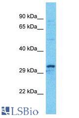 KCTD15 antibody Western Blot of HT1080. Antibody dilution: 1 ug/ml.