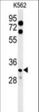 KCTD15 Antibody western blot of K562 cell line lysates (35 ug/lane). The KCTD15 antibody detected the KCTD15 protein (arrow).