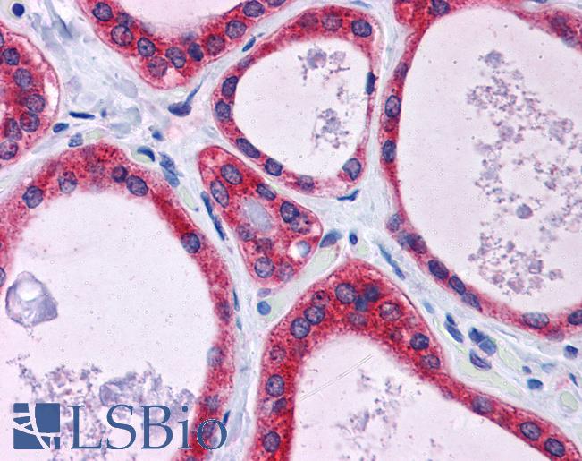 Anti-KCTD15 antibody IHC of human thyroid. Immunohistochemistry of formalin-fixed, paraffin-embedded tissue after heat-induced antigen retrieval. Antibody LS-B4997 concentration 5 ug/ml.