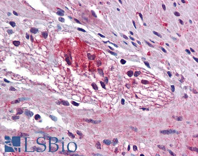 Anti-KCTD15 antibody IHC of human colon, myenteric plexus. Immunohistochemistry of formalin-fixed, paraffin-embedded tissue after heat-induced antigen retrieval. Antibody LS-B5618 concentration 5 ug/ml.