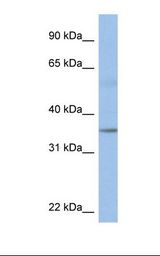 Fetal heart lysate. Antibody concentration: 1.0 ug/ml. Gel concentration: 12%.