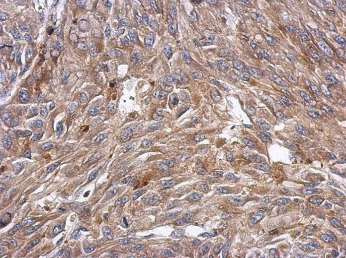 IHC of paraffin-embedded U87 xenograft, using KCTD4 antibody at 1:500 dilution.