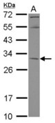 Sample (30 ug of whole cell lysate) A: A431 12% SDS PAGE KCTD4 antibody diluted at 1:1000