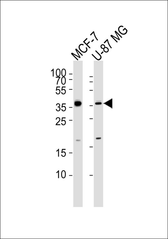 Western blot of lysates from MCF-7, U-87 MG cell line (from left to right) with KCTD4 Antibody. Antibody was diluted at 1:1000 at each lane. A goat anti-rabbit IgG H&L (HRP) at 1:5000 dilution was used as the secondary antibody. Lysates at 35 ug per lane.