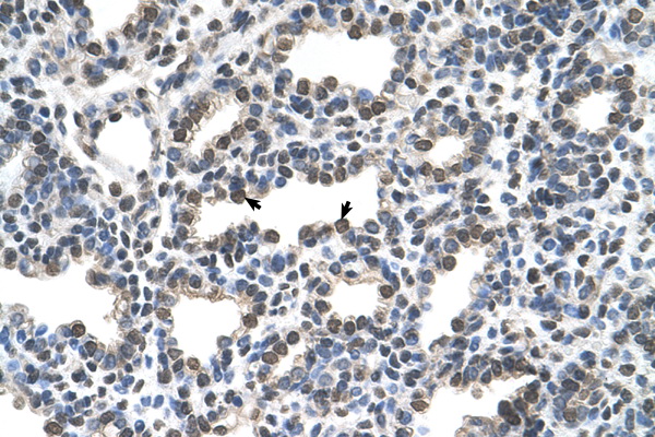 KCTD6 antibody LS-C40297 IHC of formalin-fixed, paraffin-embedded human Lung. Positive label: Alveolar cells indicated with arrows. Antibody concentration 16 0 mg m1. Magnification 400X.