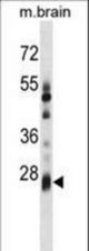 KCTD6 Antibody western blot of mouse brain tissue lysates (35 ug/lane). The KCTD6 antibody detected the KCTD6 protein (arrow).