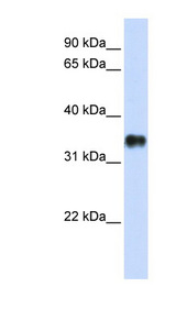 KCTD7 antibody LS-C101546 Western blot of Transfected 293T cell lysate.