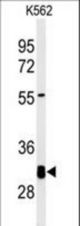 Western blot of KCTD7 Antibody in K562 cell line lysates (35 ug/lane). KCTD7 (arrow) was detected using the purified antibody.