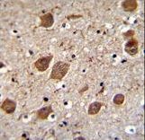 KCTD8 Antibody immunohistochemistry of formalin-fixed and paraffin-embedded human brain tissue followed by peroxidase-conjugated secondary antibody and DAB staining.