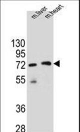 KCTD8 Antibody western blot of mouse liver and heart tissue lysates (35 ug/lane). The KCTD8 antibody detected the KCTD8 protein (arrow).