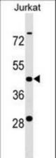 KCTD9 Antibody western blot of Jurkat cell line lysates (35 ug/lane). The KCTD9 antibody detected the KCTD9 protein (arrow).