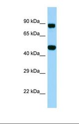 Western blot of Human PANC1. KDELC2 antibody dilution 1.0 ug/ml.