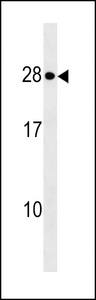 KDELR1 Antibody western blot of MCF-7 cell line lysates (35 ug/lane). The KDELR1 antibody detected the KDELR1 protein (arrow).