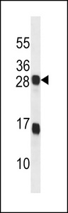 KDELR2 Antibody western blot of T47D cell line lysates (35 ug/lane). The KDELR2 antibody detected the KDELR2 protein (arrow).