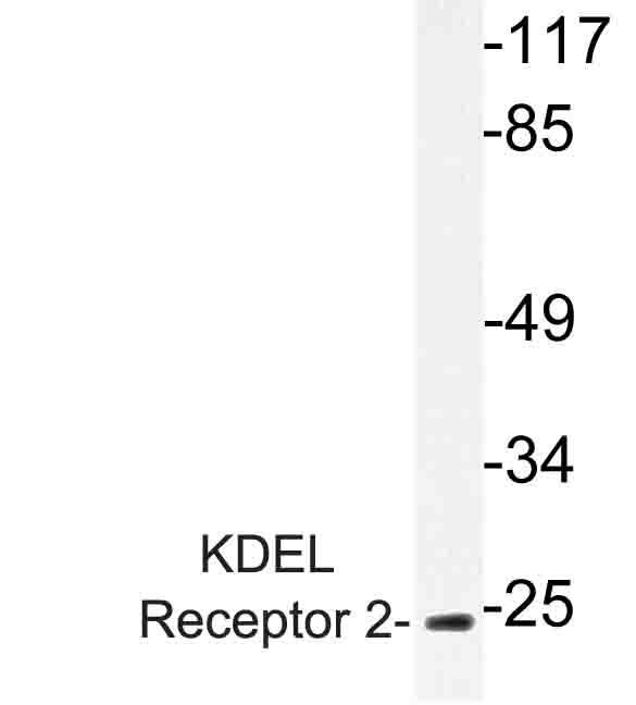 Western blot of KDEL Receptor 2 (L119) pAb in extracts from HUVEC cells.