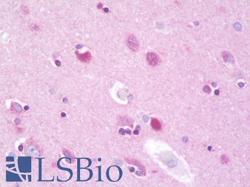 Anti-KDELR2 antibody IHC staining of human brain, cortex. Immunohistochemistry of formalin-fixed, paraffin-embedded tissue after heat-induced antigen retrieval. Antibody LS-B9834 concentration 10 ug/ml.