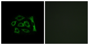 Immunofluorescence of A549 cells, using ERD22 Antibody. The picture on the right is treated with the synthesized peptide.