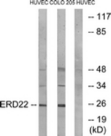 Western blot of extracts from HUVEC/COLO cells, using ERD22 Antibody. The lane on the right is treated with the synthesized peptide.