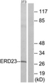 Western blot of extracts from NIH-3T3 cells, using ERD23 Antibody. The lane on the right is treated with the synthesized peptide.