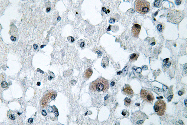 IHC of KDEL Receptor 3 (L95) pAb in paraffin-embedded human brain tissue.