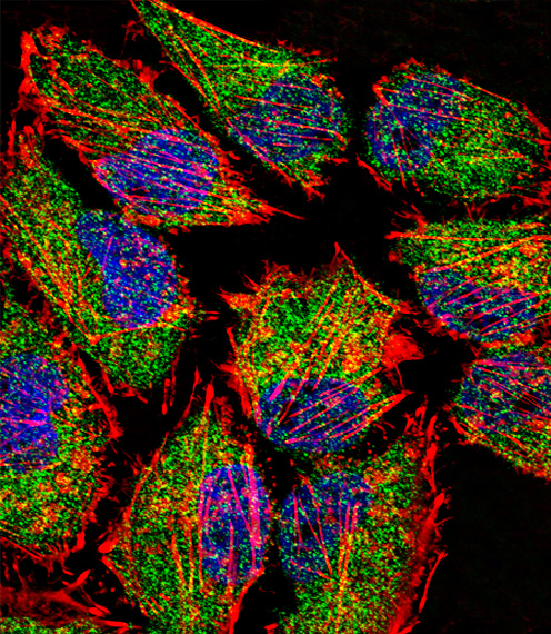 Fluorescent confocal image of HeLa cell stained with LSD1 Antibody. HeLa cells were fixed with 4% PFA (20 min), permeabilized with Triton X-100 (0.1%, 10 min), then incubated with LSD1 primary antibody (1:25, 1 h at 37°C). For secondary antibody, Alexa Fluor 488 conjugated donkey anti-rabbit antibody (green) was used (1:400, 50 min at 37°C). Cytoplasmic actin was counterstained with Alexa Fluor 555 (red) conjugated Phalloidin (7units/ml, 1 h at 37°C). Nuclei were counterstained with DAPI (blue) (10 ug/ml, 10 min). LSD1 immunoreactivity is localized to Cytoplasm significantly and Nucleus weakly.