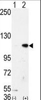 Western blot of AOF2 (arrow) using LSD1 Antibody. 293 cell lysates (2 ug/lane) either nontransfected (Lane 1) or transiently transfected with the AOF2 gene (Lane 2) (Origene Technologies).