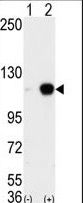 Western blot of AOF2 (arrow) using LSD1 Antibody. 293 cell lysates (2 ug/lane) either nontransfected (Lane 1) or transiently transfected with the AOF2 gene (Lane 2) (Origene Technologies).