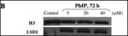 Western immunoblot. Nuclear extracts of control and PhIP-treated HMEC. Proteins were transferred onto polyvinylidene difluoride and blotted with anti-LSD1 antibody. Nuclear LSD1 protein levels increased in carcinogen-treated HMEC compared with control HMEC.