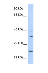 GRB2 antibody LS-C146042 Western blot of 721_B Cell lysate. Antibody concentration 1 ug/ml.