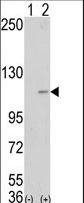 Western blot of AOF2 (arrow) using LSD1 Antibody. 293 cell lysates (2 ug/lane) either nontransfected (Lane 1) or transiently transfected with the AOF2 gene (Lane 2) (Origene Technologies).