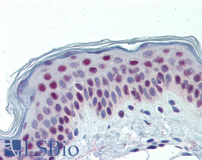 Anti-KDM1A / LSD1 antibody IHC of human skin. Immunohistochemistry of formalin-fixed, paraffin-embedded tissue after heat-induced antigen retrieval. Antibody LS-B3799 concentration 5 ug/ml.