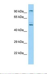Western blot of Human A549. KDM1B antibody dilution 1.0 ug/ml.