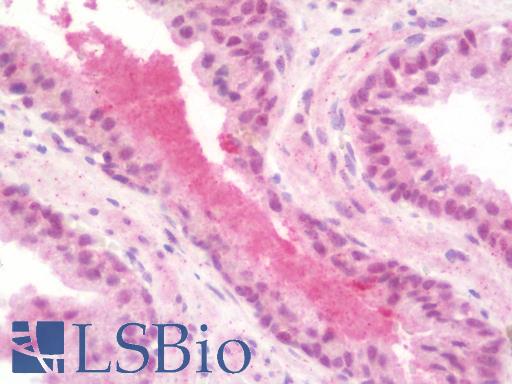 Anti-KDM1B antibody IHC staining of human prostate. Immunohistochemistry of formalin-fixed, paraffin-embedded tissue after heat-induced antigen retrieval. Antibody LS-B10141 concentration 10 ug/ml.