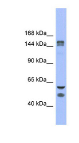 KDM2B / FBXL10 antibody LS-B5649 Western blot of Fetal Stomach lysate.
