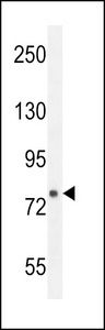 FBXL10b western blot of mouse bladder tissue lysates (35 ug/lane). The FBXL10b antibody detected the FBXL10b protein (arrow).