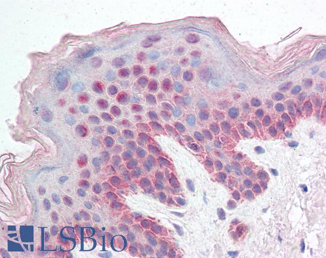 Anti-KDM2B antibody IHC of human skin. Immunohistochemistry of formalin-fixed, paraffin-embedded tissue after heat-induced antigen retrieval. Antibody LS-B2333 concentration 5 ug/ml.