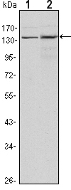Western blot using KDM3A mouse monoclonal antibody against HeLa (1) and HepG2 (2) cell lysate.