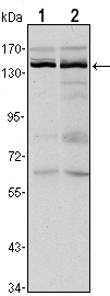 Western blot using KDM3A mouse monoclonal antibody against HeLa (1) and HepG2 (2) cell lysate.