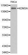 Western blot analysis of extracts of HeLa cell line, using KDM3A antibody.