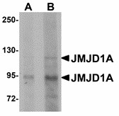 Western blot of JMJD1A in mouse liver tissue lysate with JMJD1A antibody at (A) 1 and (B) 2 ug/ml. Below: Immunohistochemistry of JMJD1A in rat liver tissue with JMJD1A antibody at 5 ug/ml.