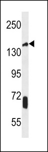 JHDM2a Antibody western blot of uterus tumor cell line lysates (35 ug/lane). The JHDM2a antibody detected the JHDM2a protein (arrow).